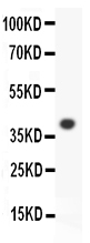 1 - Anti-ALOX15 Picoband Antibody ABO11788