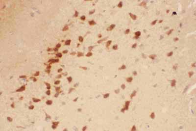 2 - Anti-BDNF Picoband Antibody ABO11789