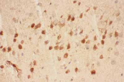 2 - Anti-BDNF Picoband Antibody ABO11789