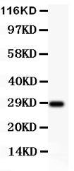1 - Anti-BDNF Picoband Antibody ABO11789
