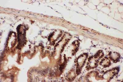 2 - Anti-Beclin 1 Picoband Antibody ABO11790