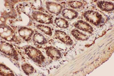 2 - Anti-Beclin 1 Picoband Antibody ABO11790