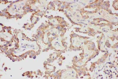 2 - Anti-Galectin-3/LGALS3 Antibody ABO11793