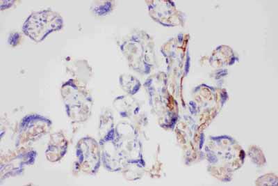 2 - Anti-Galectin-3/LGALS3 Antibody ABO11793
