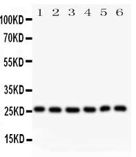 1 - Anti-Galectin-3/LGALS3 Antibody ABO11793