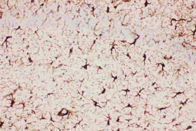 2 - Anti-GFAP Picoband Antibody ABO11794