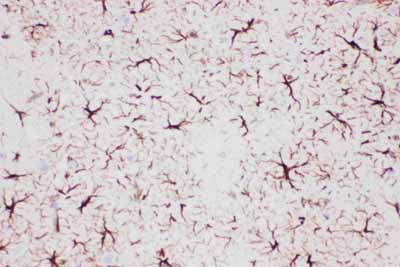 2 - Anti-GFAP Picoband Antibody ABO11794