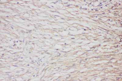 2 - Anti-GFAP Picoband Antibody ABO11794