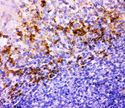 2 - Anti-ITGB1 Picoband Antibody ABO11795