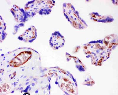2 - Anti-ITGB1 Picoband Antibody ABO11795
