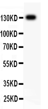 1 - Anti-ITGB1 Picoband Antibody ABO11795