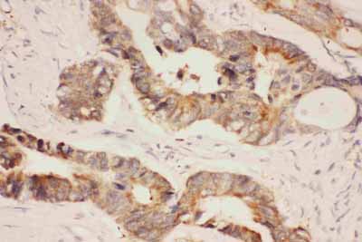 2 - Anti-Hsp90 Alpha Picoband Antibody ABO11798