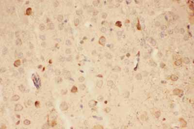 2 - Anti-Hsp90 Alpha Picoband Antibody ABO11798