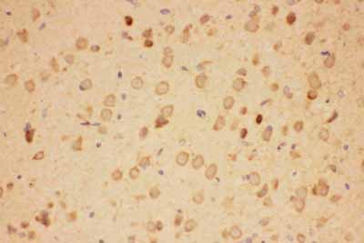 2 - Anti-Hsp90 Alpha Picoband Antibody ABO11798