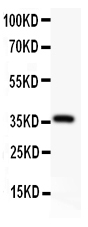 1 - Anti-AFP Picoband Antibody ABO11799