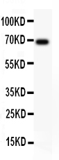 1 - Anti-AFP Picoband Antibody ABO11799