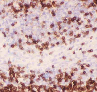 2 - Anti-CD3 Epsilon Picoband Antibody ABO11801