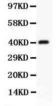 1 - Anti-CD3 Epsilon Picoband Antibody ABO11801
