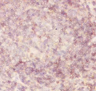 2 - Anti-CD45 Picoband Antibody ABO11804