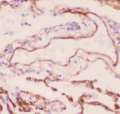 2 - Anti-Collagen IV Picoband Antibody ABO11806