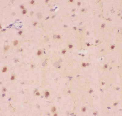 2 - Anti-Crk p38 Picoband Antibody ABO11808