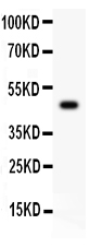 1 - Anti-CSK Picoband Antibody ABO11809
