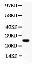 1 - Anti-Cyclin D3 Picoband Antibody ABO11810