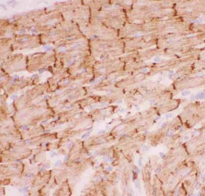 2 - Anti-Desmin Picoband Antibody ABO11812