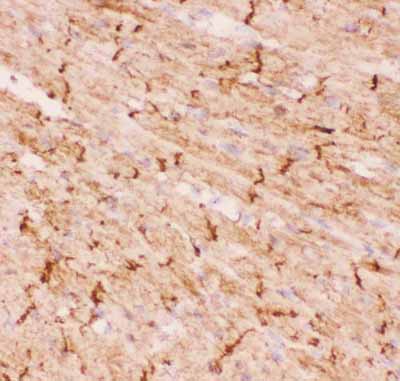 2 - Anti-Desmin Picoband Antibody ABO11812