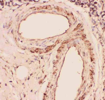 2 - Anti-Desmin Picoband Antibody ABO11812
