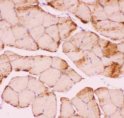 2 - Anti-Desmin Picoband Antibody ABO11812