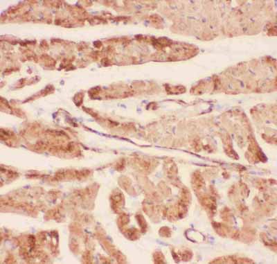 2 - Anti-Desmin Picoband Antibody ABO11812