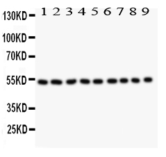 1 - Anti-Desmin Picoband Antibody ABO11812