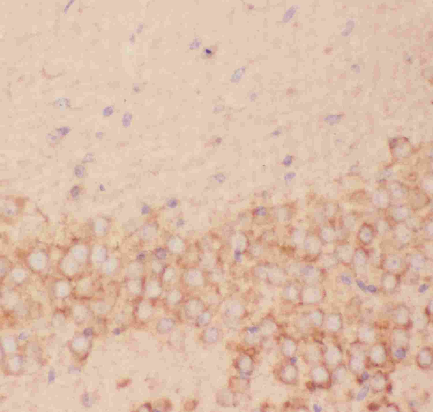 2 - Anti-FSH Beta Picoband Antibody ABO11813