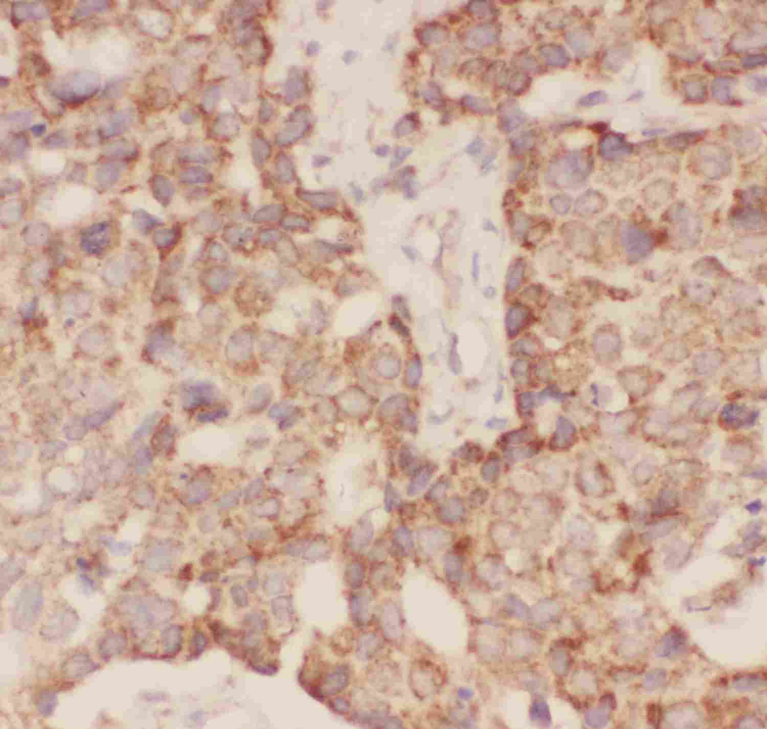 2 - Anti-FSH Beta Picoband Antibody ABO11813