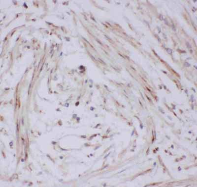2 - Anti-GLUT4 Picoband Antibody ABO11815