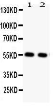 1 - Anti-GLUT4 Picoband Antibody ABO11815