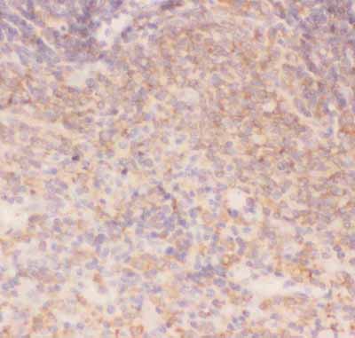 2 - Anti-IKK Alpha Picoband Antibody ABO11816