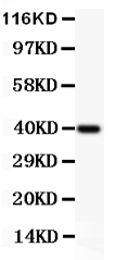 1 - Anti-IKK Alpha Picoband Antibody ABO11816