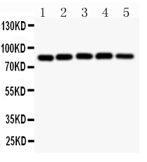 1 - Anti-IKK Alpha Picoband Antibody ABO11816
