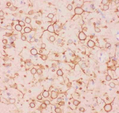 2 - Anti-Kv2.1 Picoband Antibody ABO11817