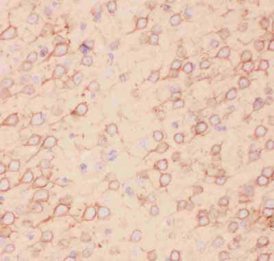 2 - Anti-Kv2.1 Picoband Antibody ABO11817
