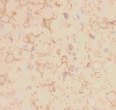 2 - Anti-Kv2.1 Picoband Antibody ABO11817