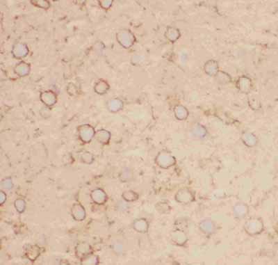 2 - Anti-Kv2.1 Picoband Antibody ABO11817