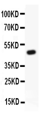 1 - Anti-Kv2.1 Picoband Antibody ABO11817