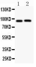 1 - Anti-Kv2.1 Picoband Antibody ABO11817