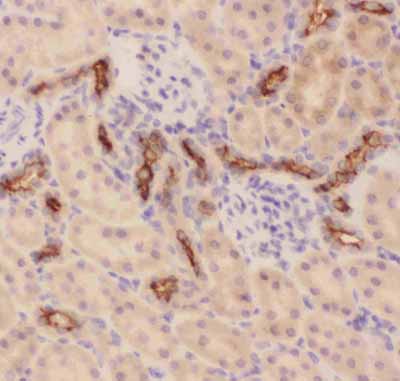 2 - Anti-MUC1 Picoband Antibody ABO11818