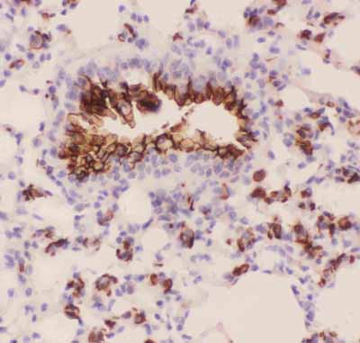 2 - Anti-MUC1 Picoband Antibody ABO11818