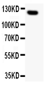 1 - Anti-MUC1 Picoband Antibody ABO11818