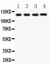 1 - Anti-CIAS1/NALP3 Picoband Antibody ABO11819